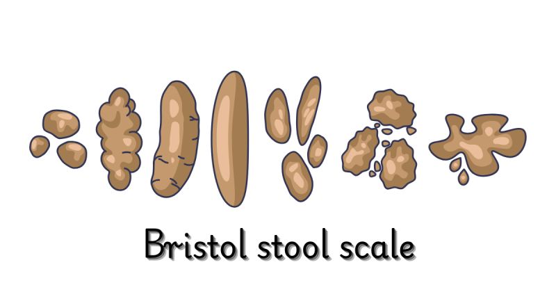 Ako vyzerá zdravá stolica?    