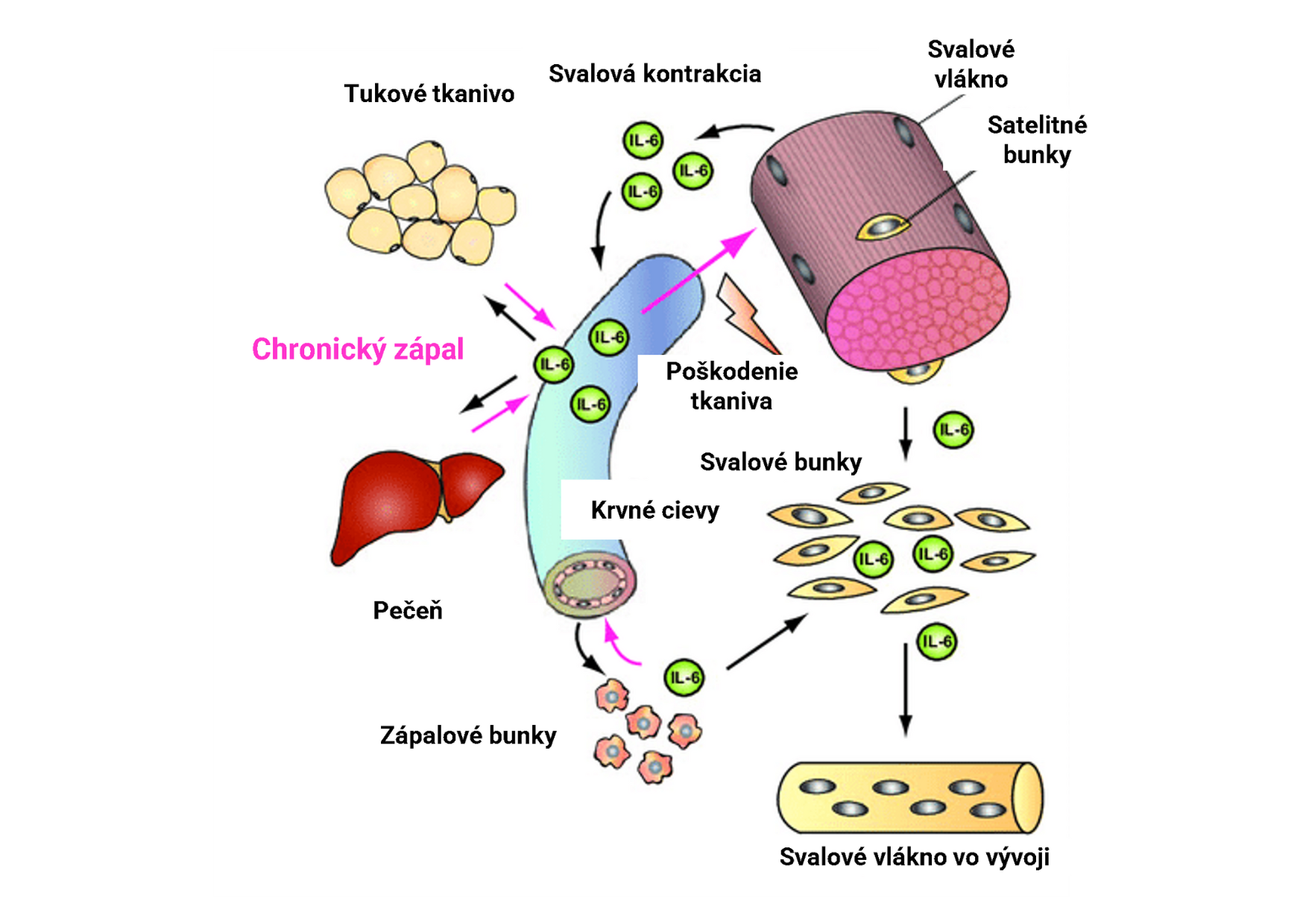 Pôsobenie IL6 v tele športovca