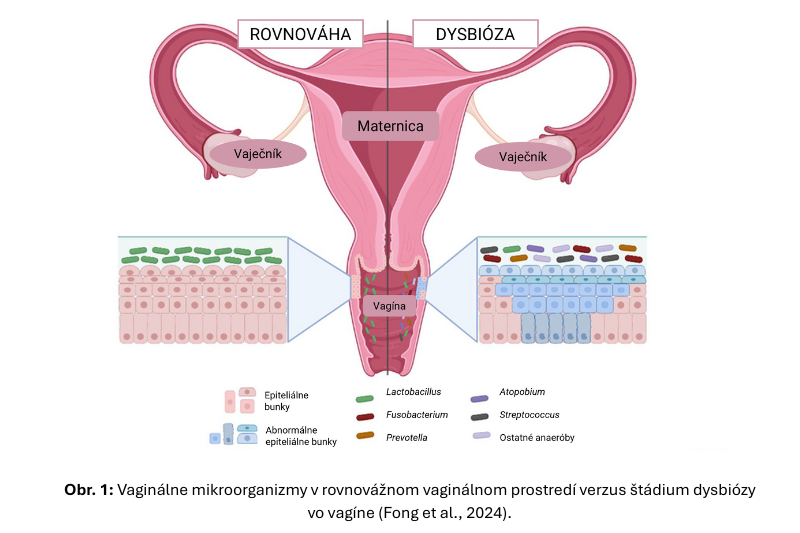 Infografika zobrazujúca rozdiel v bakteriálnom zložení vaginálneho mikrobiómu u žien v stave rovnováhy a dysbiózy.